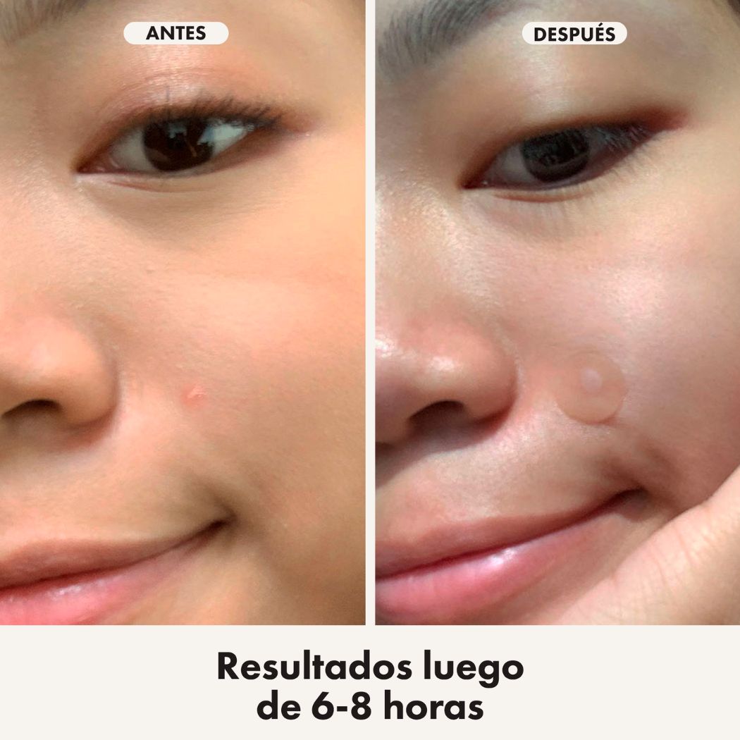 Hero Cosmetics Mighty Patch Duo Original + Invisible (12 parches)