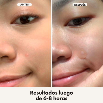 Hero Cosmetics Mighty Patch Duo Original + Invisible (12 parches)