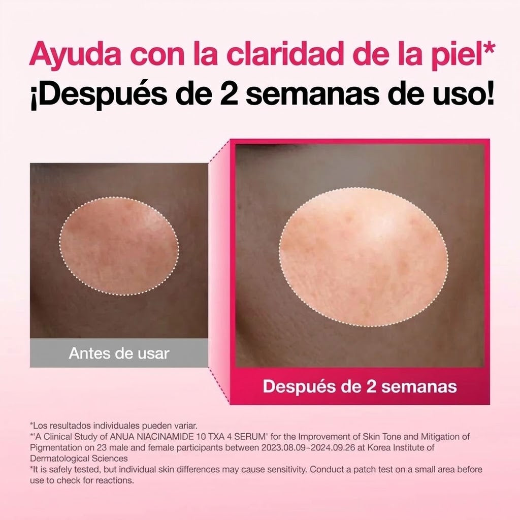 Anua Niacinamide 10% + TXA 4% Serum 30 ml