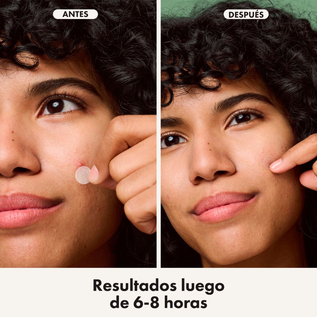 Hero Cosmetics Mighty Patch Invisible (24 parches)